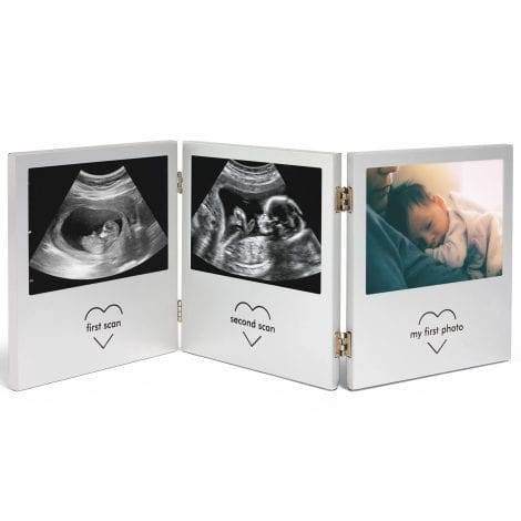 VonHaus Baby Scan Photo Frame – A beautiful frame to showcase baby scans and ultrasound photos.